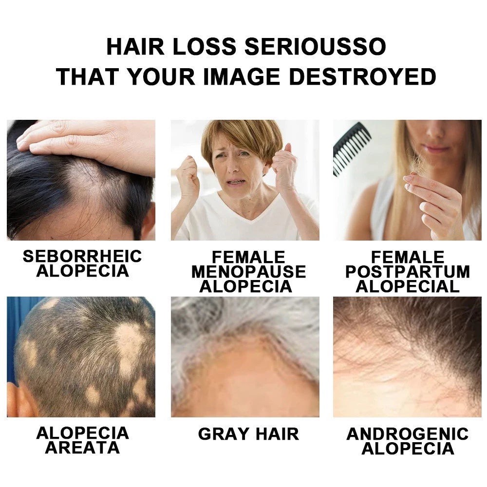 The Ordinary Multi-Peptide Serum for Hair Density