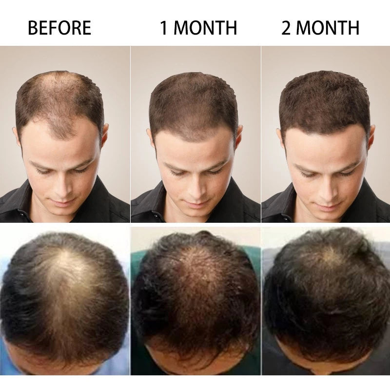 The Ordinary Multi-Peptide Serum for Hair Density