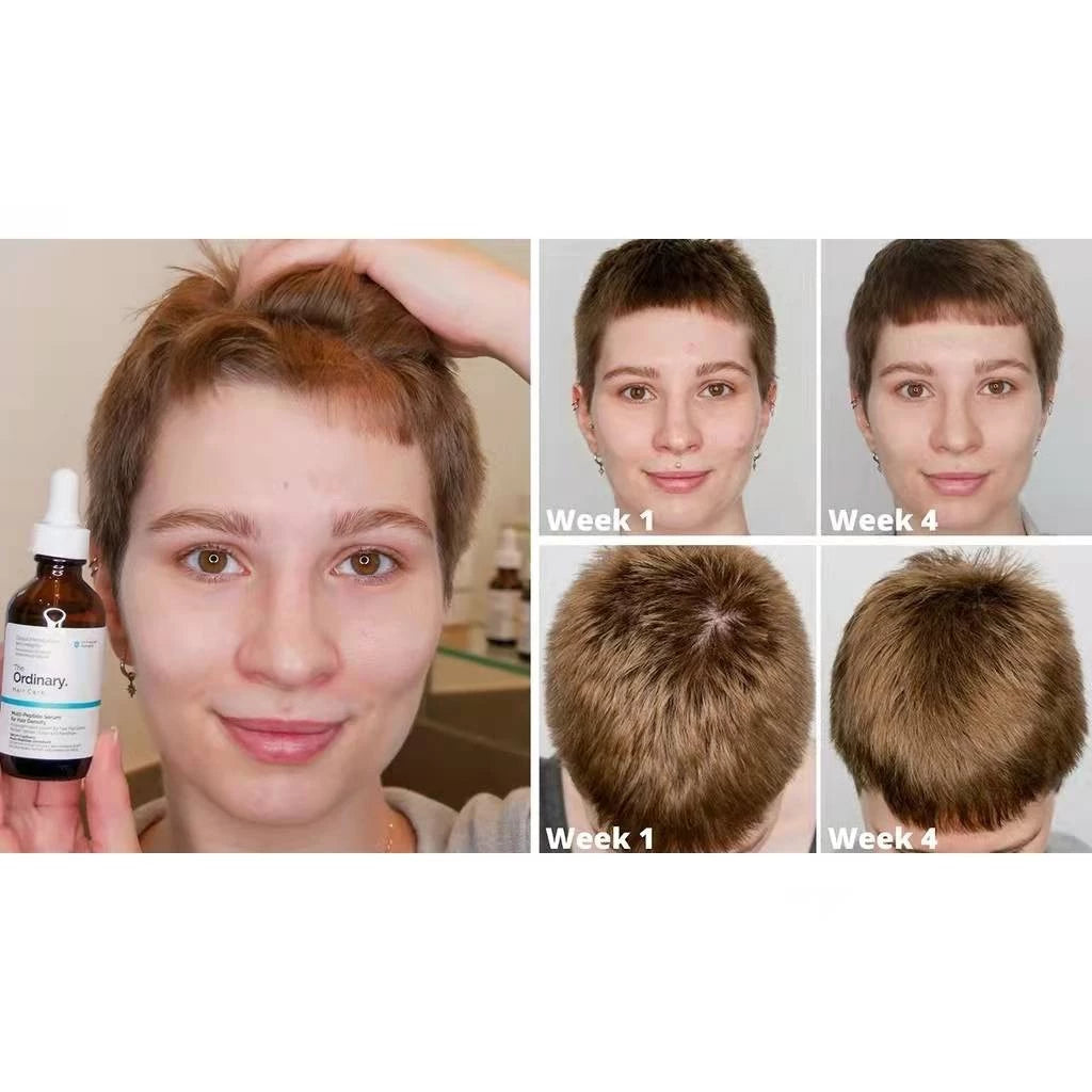 The Ordinary Multi-Peptide Serum for Hair Density