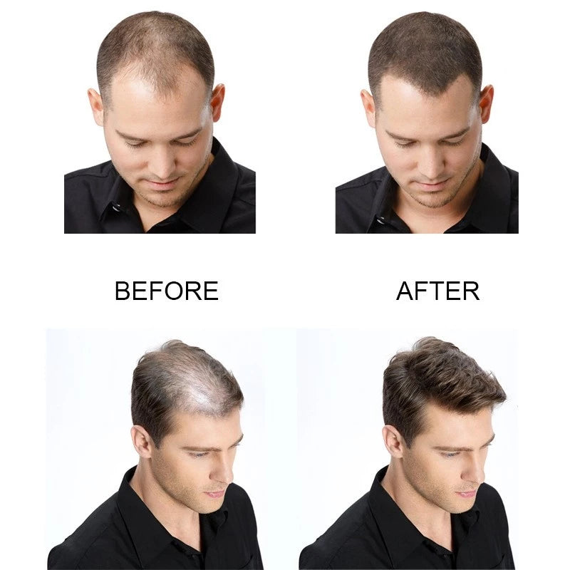 The Ordinary Multi-Peptide Serum for Hair Density