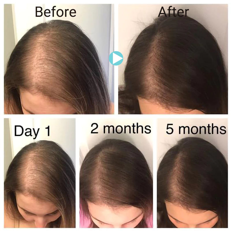 The Ordinary Multi-Peptide Serum for Hair Density